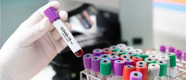 Covid19 crash update we are buying